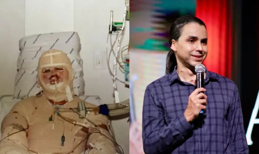 Entre o fogo e o milagre: pastor David Augusto sobrevive a acidente, desafia a medicina e testemunha nova vida após 22 anos